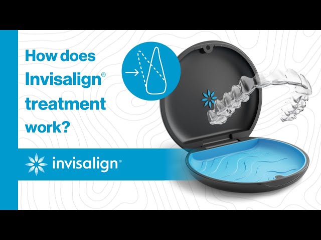 Illustration of Invisalign case with upper clear braces inside