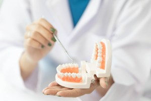 Invisalign clear braces