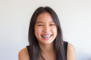 Child with Braces